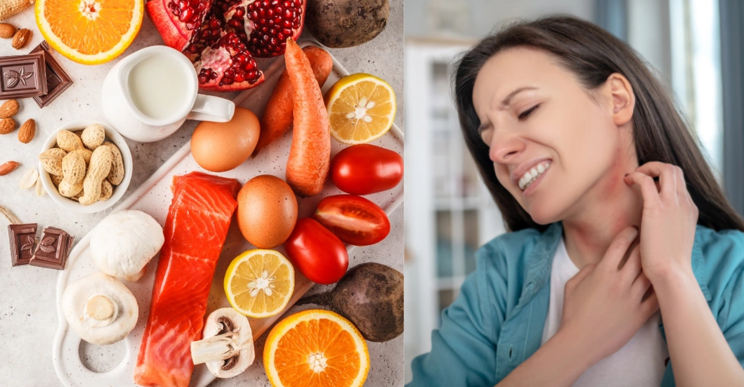 Food Allergies and Oral Health 2